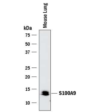 Western blot shows lysate of mouse lung tissue. PVDF membrane was probed with 0.2 µg/mL of Goat Anti-Mouse S100A9 Antigen Affinity-purified Polyclonal Antibody (Catalog # AF2065) followed by HRP-conjugated Anti-Goat IgG Secondary Antibody (HAF017). A specific band was detected for S100A9 at approximately 14 kDa (as indicated). This experiment was conducted under reducing conditions and using Immunoblot Buffer Group 1.