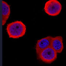 S100A9 was detected in immersion fixed MDA-MB-468 human breast cancer cell line using Sheep Anti-Human S100A9 Antigen Affinity-purified Polyclonal Antibody (Catalog # AF5578) at 1.7 µg/mL for 3 hours at room temperature. Cells were stained using the NorthernLights™ 557-conjugated Anti-Sheep IgG Secondary Antibody (red; Catalog # NL010) and counterstained with DAPI (blue). Specific staining was localized to cytoplasm. View our protocol for Fluorescent ICC Staining of Cells on Coverslips.