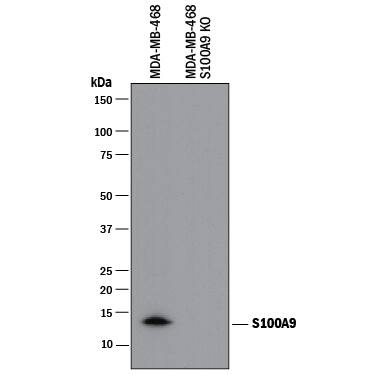 <b>Genetic Strategies Validation. </b>Western blot shows lysates of MDA-MB-468 human breast cancer parental cell line and S100A9 knock out MDA-MB-468 cell line (KO). PVDF membrane was probed with 0.2 µg/mL of Sheep Anti-Human S100A9 Antigen Affinity-purified Polyclonal Antibody (Catalog # AF5578) followed by HRP-conjugated Anti-Sheep IgG Secondary Antibody (Catalog # HAF016). A specific band was detected for S100A9 at approximately 14 kDa (as indicated) in the parental MDA-MB-468 cell line, but is not detectable in knockout MDA-MB-468 cell line. This experiment was conducted under reducing conditions and using Immunoblot Buffer Group 1.