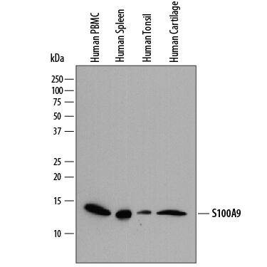 Western blot shows lysates of human peripheral blood mononuclear cells (PBMC), human spleen tissue, human tonsil tissue, and human cartilage tissue. PVDF membrane was probed with 0.2 µg/mL of Sheep Anti-Human S100A9 Antigen Affinity-purified Polyclonal Antibody (Catalog # AF5578) followed by HRP-conjugated Anti-Sheep IgG Secondary Antibody (Catalog # HAF016). A specific band was detected for S100A9 at approximately 14 kDa (as indicated). This experiment was conducted under reducing conditions and using Immunoblot Buffer Group 1.