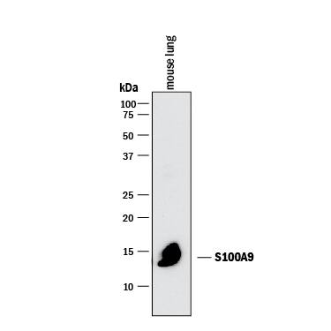 Western blot shows lysates of mouse leukocytes. PVDF membrane was probed with 2 µg/mL of Rat Anti-Mouse S100A9 Monoclonal Antibody (Catalog # MAB2065) followed by HRP-conjugated Anti-Rat IgG Secondary Antibody (HAF005). A specific band was detected for S100A9 at approximately 14 kDa (as indicated). This experiment was conducted under reducing conditions and using Immunoblot Buffer Group 1.
