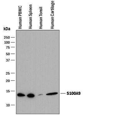 Western blot shows lysates of human peripheral blood mononuclear cells (PBMC), human spleen tissue, human tonsil tissue, and human cartilage tissue. PVDF membrane was probed with 0.5 µg/mL of Mouse Anti-Human S100A9 Monoclonal Antibody (Catalog # MAB5578) followed by HRP-conjugated Anti-Mouse IgG Secondary Antibody (Catalog # HAF018). A specific band was detected for S100A9 at approximately 14 kDa (as indicated). This experiment was conducted under reducing conditions and using Immunoblot Buffer Group 1.
