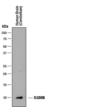 Western blot shows lysate of human brain (cerebellum) tissue. PVDF membrane was probed with 2 µg/mL of Mouse Anti-Human S100B Monoclonal Antibody (Catalog # MAB1820) followed by HRP-conjugated Anti-Mouse IgG Secondary Antibody (Catalog # HAF018). A specific band was detected for S100B at approximately 10 kDa (as indicated). This experiment was conducted under reducing conditions and using Immunoblot Buffer Group 1.