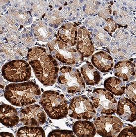 Immunohistochemistry S100P Antibody [Unconjugated]