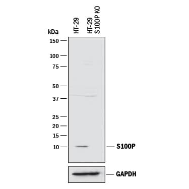 Western Blot S100P Antibody [Unconjugated]