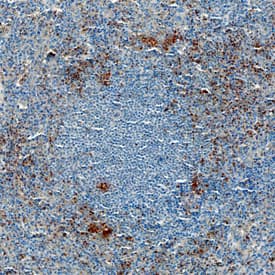 S1P3/EDG-3 was detected in immersion fixed paraffin-embedded sections of human spleen using Mouse Anti-Human S1P3/EDG-3 Monoclonal Antibody (Catalog # MAB75241) at 15 µg/mL overnight at 4 °C. Before incubation with the primary antibody, tissue was subjected to heat-induced epitope retrieval using Antigen Retrieval Reagent-Basic (Catalog # CTS013). Tissue was stained using the Anti-Mouse HRP-DAB Cell & Tissue Staining Kit (brown; Catalog # CTS002) and counterstained with hematoxylin (blue). Specific staining was localized to the marginal zone of germinal centers. View our protocol for Chromogenic IHC Staining of Paraffin-embedded Tissue Sections.