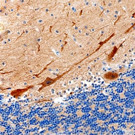 Immunohistochemistry SACS Antibody