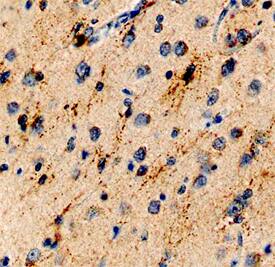 SALM3/LRFN4 was detected in immersion fixed paraffin-embedded sections of human brain (cerebellum) using Mouse Anti-Human SALM3/LRFN4 Monoclonal Antibody (Catalog # MAB5445) at 15 µg/mL overnight at 4 °C. Before incubation with the primary antibody, tissue was subjected to heat-induced epitope retrieval using Antigen Retrieval Reagent-Basic (Catalog # CTS013). Tissue was stained using the Anti-Mouse HRP-DAB Cell & Tissue Staining Kit (brown; Catalog # CTS002) and counterstained with hematoxylin (blue). View our protocol for Chromogenic IHC Staining of Paraffin-embedded Tissue Sections.