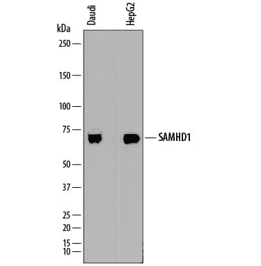 Western blot shows lysates of Daudi human Burkitt's lymphoma cell line and HepG2 human hepatocellular carcinoma cell line. PVDF membrane was probed with 1 µg/mL of Mouse Anti-Human SAMHD1 Monoclonal Antibody (Catalog # MAB8120) followed by HRP-conjugated Anti-Mouse IgG Secondary Antibody (Catalog # HAF018). A specific band was detected for SAMHD1 at approximately 72 kDa (as indicated). This experiment was conducted under reducing conditions and using Immunoblot Buffer Group 1.