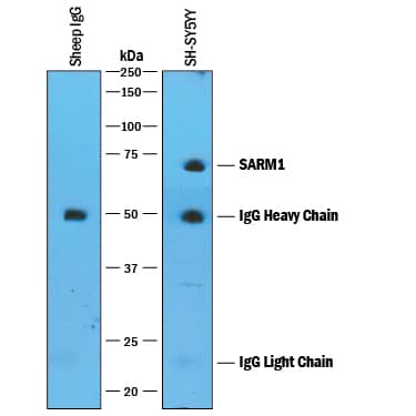 Immunoprecipitation SARM1 Antibody