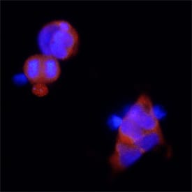 SARM1 was detected in immersion fixed HEK293 human embryonic kidney cell line using Mouse Anti-Human SARM1 Monoclonal Antibody (Catalog # MAB7037) at 25 µg/mL for 3 hours at room temperature. Cells were stained using the Northern-Lights™ 557-conjugated Anti-Mouse IgG Secondary Antibody (red; Catalog # NL007) and counterstained with DAPI (blue). Specific staining was localized to cytoplasm. View our protocol for Fluorescent ICC Staining of Cells on Coverslips.