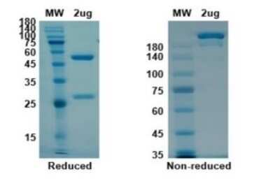 Western Blot: SARS-CoV-2 Spike S1 Antibody (B38) [NBP3-07031] - Coomassie blue staining non-reduced and reduced SDS-PAGE analysis