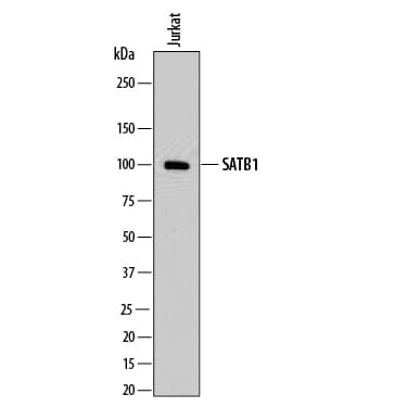 Western blot shows lysates of Jurkat human acute T cell leukemia cell line. PVDF membrane was probed with 1 µg/mL of Mouse Anti-Human SATB1 Monoclonal Antibody (Catalog # MAB8075) followed by HRP-conjugated Anti-Mouse IgG Secondary Antibody (Catalog # HAF018). A specific band was detected for SATB1 at approximately 100 kDa (as indicated). This experiment was conducted under reducing conditions and using Immunoblot Buffer Group 1.