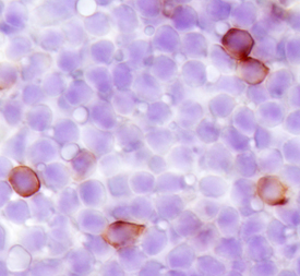 SCARA5 was detected in immersion fixed frozen sections of mouse spleen using 25 &micro;g/mL Mouse SCARA5 Monoclonal Antibody (Catalog # MAB4754) overnight at 4 &deg;C. Tissue was stained with the Anti-Rat HRP-DAB Cell & Tissue Staining Kit (brown; Catalog # CTS017) and counterstained with hematoxylin (blue). View our protocol for Chromogenic IHC Staining of Frozen Tissue Sections.