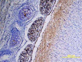 CD117/c-kit was detected in immersion fixed frozen sections of mouse embryo using Goat Anti-Human/Mouse CD117/c-kit Antigen Affinity-purified Polyclonal Antibody (Catalog # AF1356) at 15 µg/mL overnight at 4 °C. Tissue was stained using the Anti-Goat HRP-DAB Cell & Tissue Staining Kit (brown; CTS008) and counterstained with hematoxylin (blue). View our protocol for Chromogenic IHC Staining of Frozen Tissue Sections.