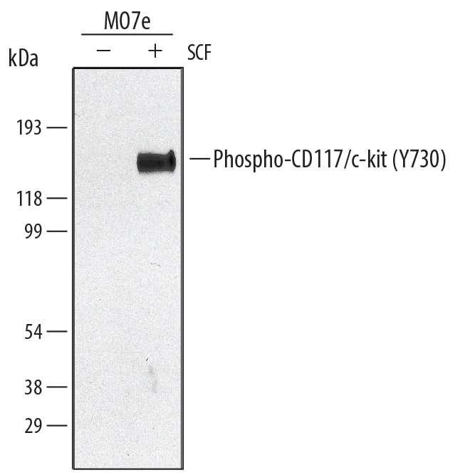 Western blot shows lysates of MO7e human megakaryocytic leukemic cell line untreated (-) or treated (+) with 100 ng/mL Recombinant Human SCF/c-kit Ligand (Catalog # 255-SC) for 10 minutes. PVDF membrane was probed with 0.5 µg/mL of Rabbit Anti-Human Phospho-CD117/c-kit (Y730) Antigen Affinity-purified Polyclonal Antibody (Catalog # AF3527), followed by HRP-conjugated Anti-Rabbit IgG Secondary Antibody (Catalog # HAF008). A specific band was detected for Phospho-CD117/c-kit (Y730) at approximately 145 kDa (as indicated). This experiment was conducted under reducing conditions and using Immunoblot Buffer Group 1.