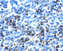 SCGF/CLEC11a was detected in immersion fixed paraffin-embedded sections of human spleen using 25 µg/mL Mouse Anti-Human SCGF/CLEC11a Monoclonal Antibody (Catalog # MAB1904) overnight at 4 °C. Tissue was stained with the Anti-Mouse HRP-DAB Cell & Tissue Staining Kit (brown; Catalog # CTS002) and counterstained with hematoxylin (blue). View our protocol for Fluorescent ICC Staining of Cells on Coverslips.