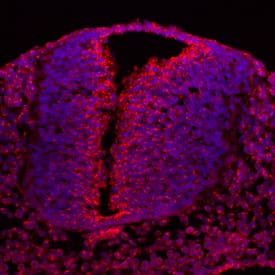 Immunohistochemistry SDNSF/MCFD2 Antibody