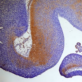 SECTM1A was detected in immersion fixed frozen sections of mouse embryo (13 d.p.c.) using Sheep Anti-Mouse SECTM1A Antigen Affinity-purified Polyclonal Antibody (Catalog # AF7837) at 15 µg/mL overnight at 4 °C. Tissue was stained using the Anti-Sheep HRP-DAB Cell & Tissue Staining Kit (brown; Catalog # CTS019) and counterstained with hematoxylin (blue). View our protocol for Chromogenic IHC Staining of Frozen Tissue Sections.