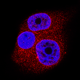 Immunocytochemistry SENP1 Antibody [Unconjugated]