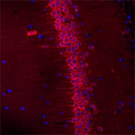 SEZ6L was detected in perfusion fixed frozen sections of mouse brain (hippocampus) using Sheep Anti-Mouse SEZ6L Antigen Affinity-purified Polyclonal Antibody (Catalog # AF4804) at 1.7 µg/mL overnight at 4 °C. Tissue was stained using the NorthernLights™ 557-conjugated Anti-Sheep IgG Secondary Antibody (red; Catalog # <a class=