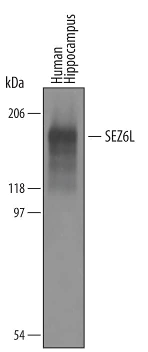 Western blot shows lysates of human hippocampal tissue. PVDF membrane was probed with 1 µg/mL of Goat Anti-Human SEZ6L Antigen Affinity-purified Polyclonal Antibody (Catalog # AF5598) followed by HRP-conjugated Anti-Goat IgG Secondary Antibody (Catalog # HAF019). A specific band was detected for SEZ6L at approximately 190 kDa (as indicated). This experiment was conducted under reducing conditions and using Immunoblot Buffer Group 8.