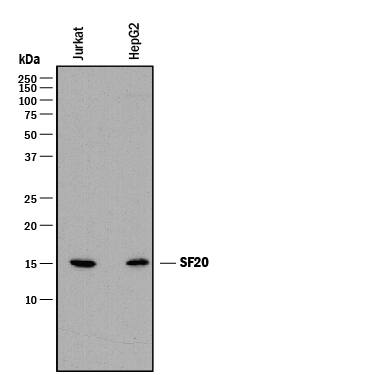 Western Blot SF20/MYDGF Antibody [Unconjugated]
