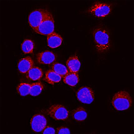 Immunocytochemistry SF20/MYDGF Antibody (2562A) [Unconjugated]