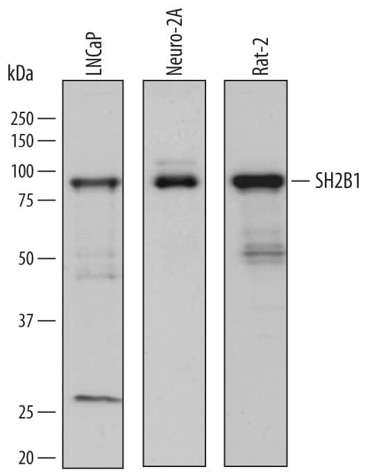 Western Blot SH2B1 Antibody