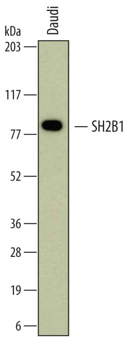 Western blot shows lysates of Daudi human Burkitt's lymphoma cell line. PVDF membrane was probed with 1 µg/mL of Mouse Anti-Human SH2B1 Monoclonal Antibody (Catalog # MAB6915) followed by HRP-conjugated Anti-Mouse IgG Secondary Antibody (Catalog # HAF007). A specific band was detected for SH2B1 at approximately 80 kDa (as indicated). This experiment was conducted under reducing conditions and using Immunoblot Buffer Group 1.