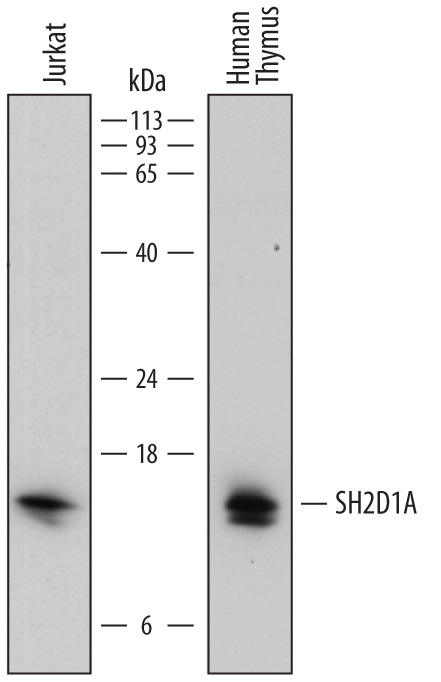 Western Blot SH2D1A Antibody (782702)