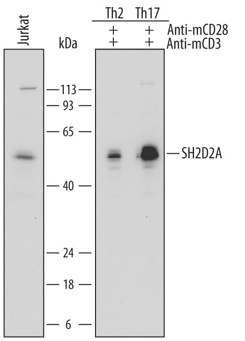Western blot shows lysates of Jurkat human acute T cell leukemia cell line (untreated), human primary differentiated Th2 cells and human primary differentiated Th17 cells treated (+) with 1 µg/mL Hamster Anti-Mouse CD3e Monoclonal Antibody (Catalog # MAB484) and 5 µg/mL Rat Anti-Mouse CD28 Monoclonal Antibody (Catalog # MAB4831) for 120 minutes. PVDF membrane was probed with 1 µg/mL of Sheep Anti-Human SH2D2A Polyclonal Antibody (Catalog # AF6020) followed by HRP-conjugated Anti-Sheep IgG Secondary Antibody (Catalog # HAF016). A specific band was detected for SH2D2A at approximately 52 kDa (as indicated). This experiment was conducted under reducing conditions and using Immunoblot Buffer Group 1.
