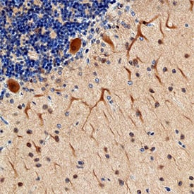 SHANK2 was detected in immersion fixed paraffin-embedded sections of human brain (cerebellum) using Sheep Anti-Human SHANK2 Antigen Affinity-purified Polyclonal Antibody (Catalog # AF7035) at 3 µg/mL overnight at 4 °C. Tissue was stained using the Anti-Sheep HRP-DAB Cell & Tissue Staining Kit (brown; Catalog # CTS019) and counterstained with hematoxylin (blue). Specific staining was localized to cell bodies and processes in Purkinje neurons. View our protocol for Chromogenic IHC Staining of Paraffin-embedded Tissue Sections.