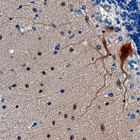SHANK2 was detected in immersion fixed paraffin-embedded sections of human brain (cerebellum) using Mouse Anti-Human SHANK2 Monoclonal Antibody (Catalog # MAB7035) at 15 µg/mL overnight at 4 °C. Before incubation with the primary antibody, tissue was subjected to heat-induced epitope retrieval using Antigen Retrieval Reagent-Basic (Catalog # CTS013). Tissue was stained using the Anti-Mouse HRP-DAB Cell & Tissue Staining Kit (brown; Catalog # CTS002) and counterstained with hematoxylin (blue). Specific staining was localized to Purkinje neurons. View our protocol for Chromogenic IHC Staining of Paraffin-embedded Tissue Sections.