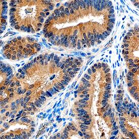 SHARPIN was detected in immersion fixed paraffin-embedded sections of human ovary using Sheep Anti-Human SHARPIN Antigen Affinity-purified Polyclonal Antibody (Catalog # AF8100) at 10 µg/mL overnight at 4 °C. Tissue was stained using the Anti-Sheep HRP-DAB Cell & Tissue Staining Kit (brown; Catalog # CTS019) and counter-stained with hematoxylin (blue). Specific staining was localized to cytoplasm. View our protocol for Chromogenic IHC Staining of Paraffin-embedded Tissue Sections.