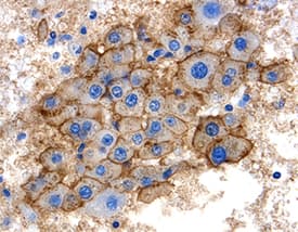 Immunohistochemistry SHBG Antibody [Unconjugated]