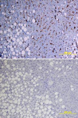 SHBG was detected in immersion fixed paraffin-embedded sections of human liver using Goat Anti-Human SHBG Biotinylated Antigen Affinity-purified Polyclonal Antibody (Catalog # BAF2656) at 15 µg/mL overnight at 4 °C. Tissue was stained using the Anti-Goat HRP-DAB Cell & Tissue Staining Kit (brown; Catalog # CTS008) and counterstained with hematoxylin (blue). Lower panel shows a lack of labeling if primary antibodies are omitted and tissue is stained only with secondary antibody followed by incubation with detection reagents. View our protocol for Chromogenic IHC Staining of Paraffin-embedded Tissue Sections.