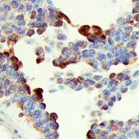 Immunohistochemistry SHB Antibody