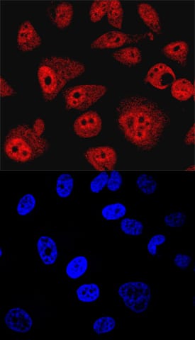SHIP2 was detected in immersion fixed PC-3 human prostate cancer cell line using Sheep Anti-Human/Mouse/Rat SHIP2 Antigen Affinity-purified Polyclonal Antibody (Catalog # AF5389) at 10 µg/mL for 3 hours at room temperature. Cells were stained using the NorthernLights™ 557-conjugated Anti-Sheep IgG Secondary Antibody (red, upper panel; Catalog # NL010) and counterstained with DAPI (blue, lower panel). Specific staining was localized to nuclei and cytoplasm. View our protocol for Fluorescent ICC Staining of Cells on Coverslips. This application has not yet been tested in mouse or rat samples.
