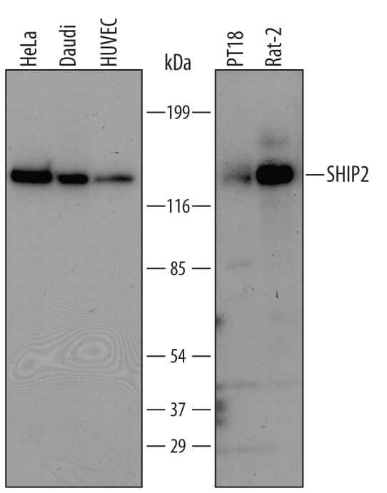 Western blot shows lysates of HeLa human cervical epithelial carcinoma cell line, Daudi human Burkitt's lymphoma cell line, HUVEC human umbilical vein endothelial cells, PT18 mouse mast/basophil cell line, and Rat-2 rat embryonic fibroblast cell line. PVDF membrane was probed with 1 µg/mL of Sheep Anti-Human/Mouse/Rat SHIP2 Antigen Affinity-purified Polyclonal Antibody (Catalog # AF5389) followed by HRP-conjugated Anti-Sheep IgG Secondary Antibody (Catalog # HAF016). A specific band was detected for SHIP2 at approximately 140 kDa (as indicated). This experiment was conducted using Immunoblot Buffer Group 1.
