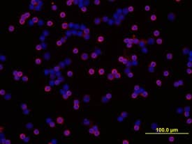 Immunocytochemistry SHIP Antibody (257812) [Unconjugated]