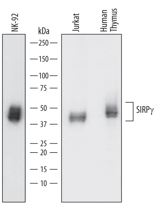 Western Blot SIRP gamma/CD172g Antibody [Unconjugated]