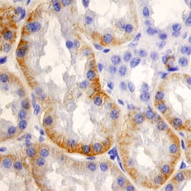 Immunohistochemistry SLC22A2/OCT2 Antibody (640438) [Unconjugated]