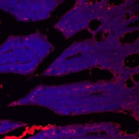 Immunohistochemistry SLC39A4/ZIP4 Antibody