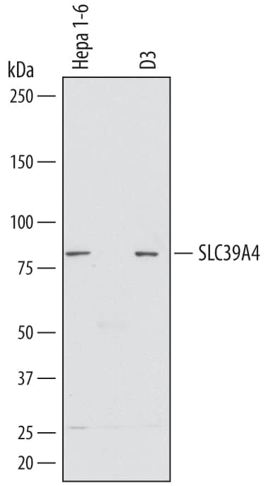 Western Blot SLC39A4/ZIP4 Antibody
