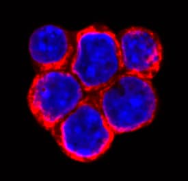 SLITRK6 was detected in immersion fixed Raji human Burkitt's lymphoma cell line using Mouse Anti-Human SLITRK6 Monoclonal Antibody (Catalog # MAB7317) at 10 µg/mL for 3 hours at room temperature. Cells were stained using the NorthernLights™ 557-conjugated Anti-Mouse IgG Secondary Antibody (red; Catalog # NL007) and counterstained with DAPI (blue). Specific staining was localized to plasma membrane. View our protocol for Fluorescent ICC Staining of Cells on Coverslips.