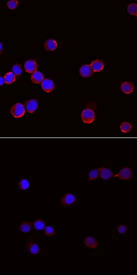 Immunocytochemistry SLP-76/LCP2 [p Tyr145] Antibody (776503) [Unconjugated]