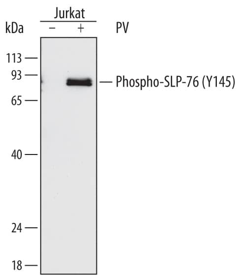 Western Blot SLP-76/LCP2 [p Tyr145] Antibody (776503) [Unconjugated]