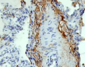 SLPI was detected in immersion fixed paraffin-embedded sections of human lung using Goat Anti-Human SLPI Antigen Affinity-purified Polyclonal Antibody (Catalog # AF1274) at 10 µg/mL overnight at 4 °C. Tissue was stained using the Anti-Goat HRP-DAB Cell & Tissue Staining Kit (brown; Catalog # CTS008) and counterstained with hematoxylin (blue). Specific staining was localized to cell surfaces and cytoplasm. View our protocol for Chromogenic IHC Staining of Paraffin-embedded Tissue Sections.