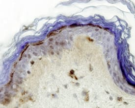Immunohistochemistry SLURP1 Antibody